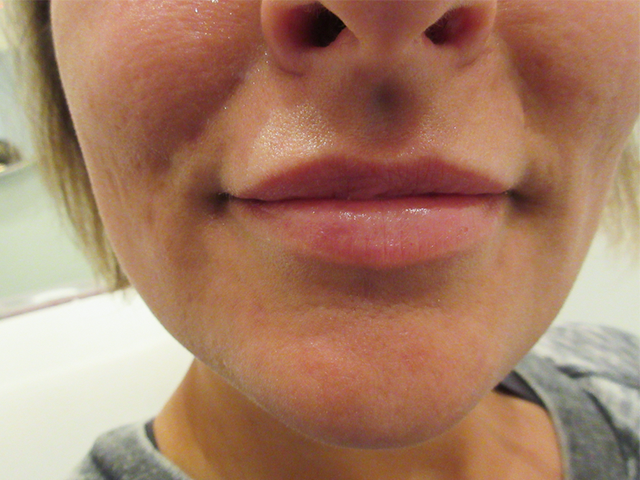Before