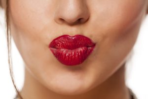 Lips with Restylane Kysse, Bellissimo Plastic Surgery and Medi Spa